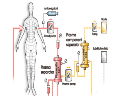 pelasma-10